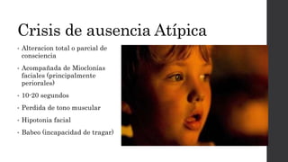 Crisis de ausencia Atípica
• Alteracion total o parcial de
consciencia
• Acompañada de Mioclonías
faciales (principalmente
periorales)
• 10-20 segundos
• Perdida de tono muscular
• Hipotonia facial
• Babeo (incapacidad de tragar)
 