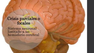 Crisis parciales o
focales
• Sistema neuronal
limitado a un
hemisferio cerebral
 