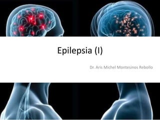 Epilepsia (I)
Dr. Aris Michel Montesinos Rebollo

 