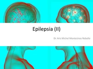 Epilepsia (II)
Dr. Aris Michel Montesinos Rebollo

 