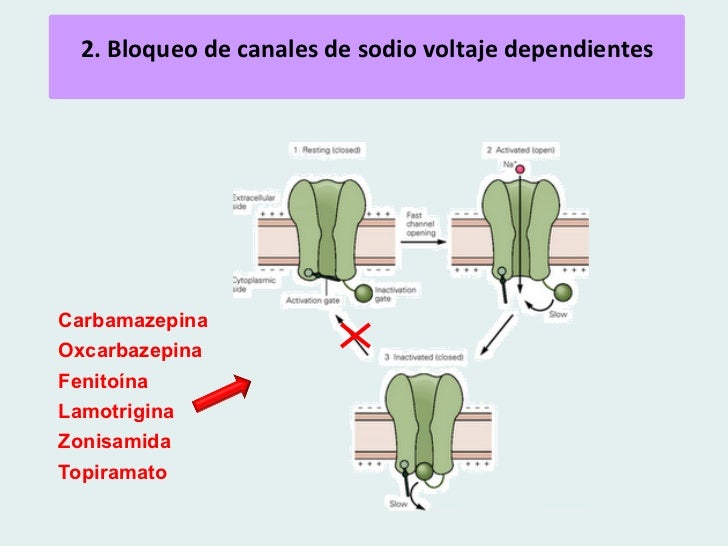 Epilepsia infantil Epilepsia infantil