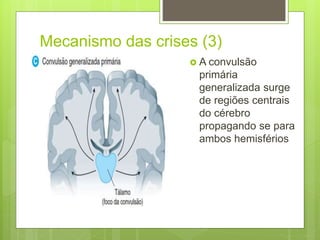 Mecanismo das crises (3)
 A convulsão
primária
generalizada surge
de regiões centrais
do cérebro
propagando se para
ambos hemisférios
 