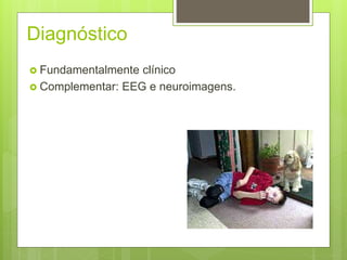 Diagnóstico
 Fundamentalmente clínico
 Complementar: EEG e neuroimagens.
 