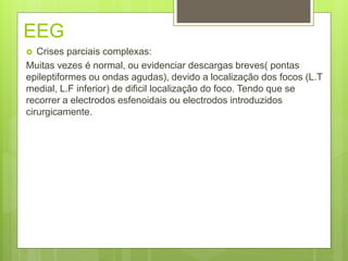 EEG
 Crises parciais complexas:
Muitas vezes é normal, ou evidenciar descargas breves( pontas
epileptiformes ou ondas agudas), devido a localização dos focos (L.T
medial, L.F inferior) de dificil localização do foco. Tendo que se
recorrer a electrodos esfenoidais ou electrodos introduzidos
cirurgicamente.
 