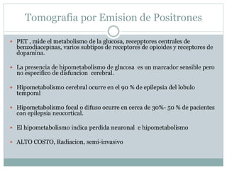 Tomografia por Emision de Positrones
 PET , mide el metabolismo de la glucosa, recepptores centrales de
benzodiacepinas, varios subtipos de receptores de opioides y receptores de
dopamina.
 La presencia de hipometabolismo de glucosa es un marcador sensible pero
no especifico de disfuncion cerebral.
 Hipometabolismo cerebral ocurre en el 90 % de epilepsia del lobulo
temporal
 Hipometabolismo focal o difuso ocurre en cerca de 30%- 50 % de pacientes
con epilepsia neocortical.
 El hipometabolismo indica perdida neuronal e hipometabolismo
 ALTO COSTO, Radiacion, semi-invasivo
 