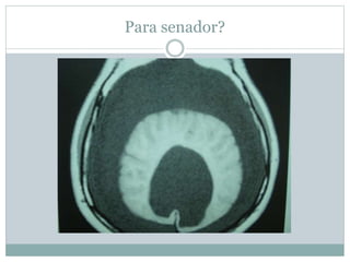 Para senador?
 