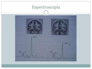 Espectroscopia
 