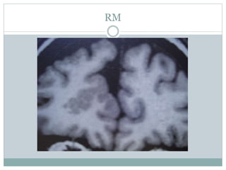 RM
 