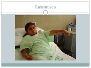 Rassmusen
 