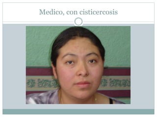 Medico, con cisticercosis
 