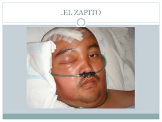 .EL ZAPITO
 