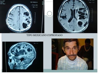 TIPO MEXICANO COPROFAGO
 