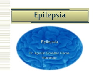 Epilepsia
Epilepsia
Dr. Agustín González Gaona
Neurologo
 