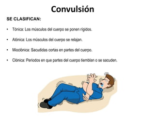 Convulsión
SE CLASIFICAN:
• Tónica: Los músculos del cuerpo se ponen rígidos.
• Atónica: Los músculos del cuerpo se relajan.
• Mioclónica: Sacudidas cortas en partes del cuerpo.
• Clónica: Periodos en que partes del cuerpo tiemblan o se sacuden.
 