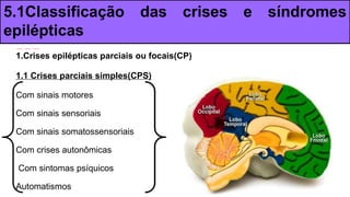 1.Crises epilépticas parciais ou focais(CP)
1.1 Crises parciais simples(CPS)
Com sinais motores
Com sinais sensoriais
Com sinais somatossensoriais
Com crises autonômicas
Com sintomas psíquicos
Automatismos
5.1Classificação das crises e síndromes
epilépticas
 