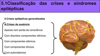 2.Crises epilépticas generalizadas
A.Crises de ausência
Apenas com perda da consciência
Com discretos componentes clônicos
Com componentes atônicos
Com componentes tônicos
Com automatismos
5.1Classificação das crises e síndromes
epilépticas
 