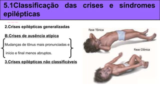 2.Crises epilépticas generalizadas
B.Crises de ausência atípica
Mudanças de tônus mais pronunciadas e
início e final menos abruptos.
3.Crises epilépticas não classificáveis
5.1Classificação das crises e síndromes
epilépticas
 