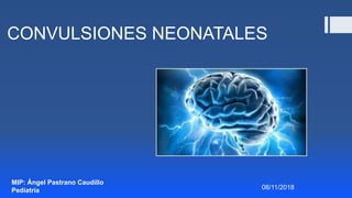CONVULSIONES NEONATALES
MIP: Ángel Pastrano Caudillo
Pediatría 08/11/2018
 