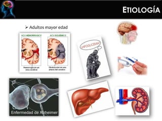  Adultos mayor edad
ETIOLOGÍA
 