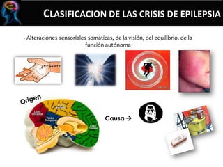 CLASIFICACION DE LAS CRISIS DE EPILEPSIA
- Alteraciones sensoriales somáticas, de la visión, del equilibrio, de la
función autónoma
Causa 
 