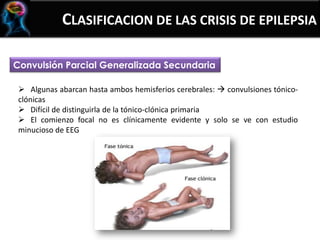 CLASIFICACION DE LAS CRISIS DE EPILEPSIA
Convulsión Parcial Generalizada Secundaria
 Algunas abarcan hasta ambos hemisferios cerebrales:  convulsiones tónico-
clónicas
 Difícil de distinguirla de la tónico-clónica primaria
 El comienzo focal no es clínicamente evidente y solo se ve con estudio
minucioso de EEG
 