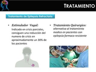 • Estimulador Vagal:
Indicado en crisis parciales,
consiguen una reducción del
numero de crisis en
aproximadamente un 30% de
los pacientes
• Tratamiento Quirurgico:
alternativa al tratamiento
medico en pacientes con
epilepsia farmaco-resistente
TRATAMIENTO
Tratamiento de Epilepsia Refractaria
 