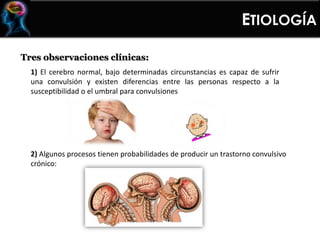 Tres observaciones clínicas:
1) El cerebro normal, bajo determinadas circunstancias es capaz de sufrir
una convulsión y existen diferencias entre las personas respecto a la
susceptibilidad o el umbral para convulsiones
2) Algunos procesos tienen probabilidades de producir un trastorno convulsivo
crónico:
ETIOLOGÍA
 