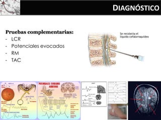 DIAGNÓSTICO
Pruebas complementarias:
- LCR
- Potenciales evocados
- RM
- TAC
 