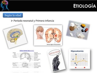 Según la edad
 Periodo neonatal y Primera Infancia
ETIOLOGÍA
 