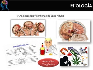  Adolescencia y comienzo de Edad Adulta
Anomalías
Congénitas
ETIOLOGÍA
 