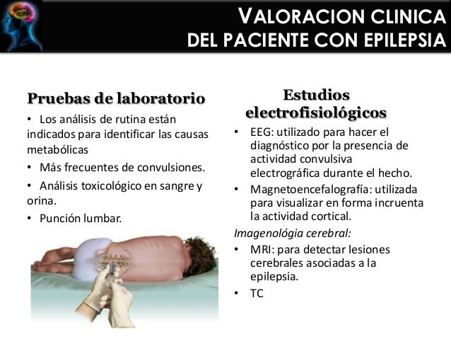 Epilepsia, status epileptico, esclerosis multiple