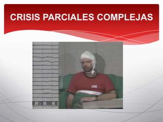 CRISIS PARCIALES COMPLEJAS
 