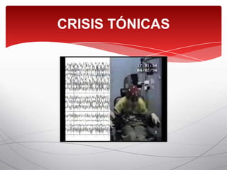 CRISIS TÓNICAS
 