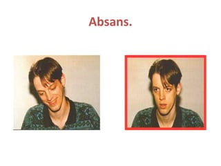 Absans.
 