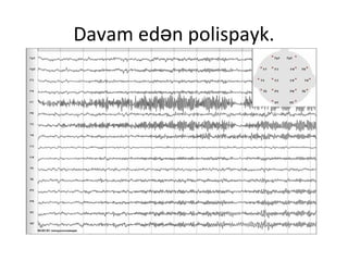 Davam ed n Ǳ貹.ə
 