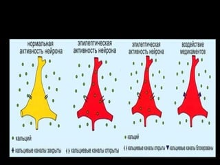 Epilepsiya yeni