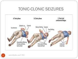 TONIC-CLONIC SEIZURES
asareor@yahoo.com © 2011
17
 