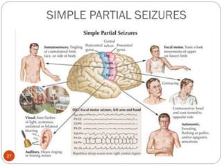 SIMPLE PARTIAL SEIZURES
asareor@yahoo.com © 2011
27
 