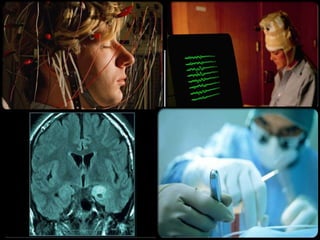 During these seizures the infant may bend and cry out.Infantile Spasms