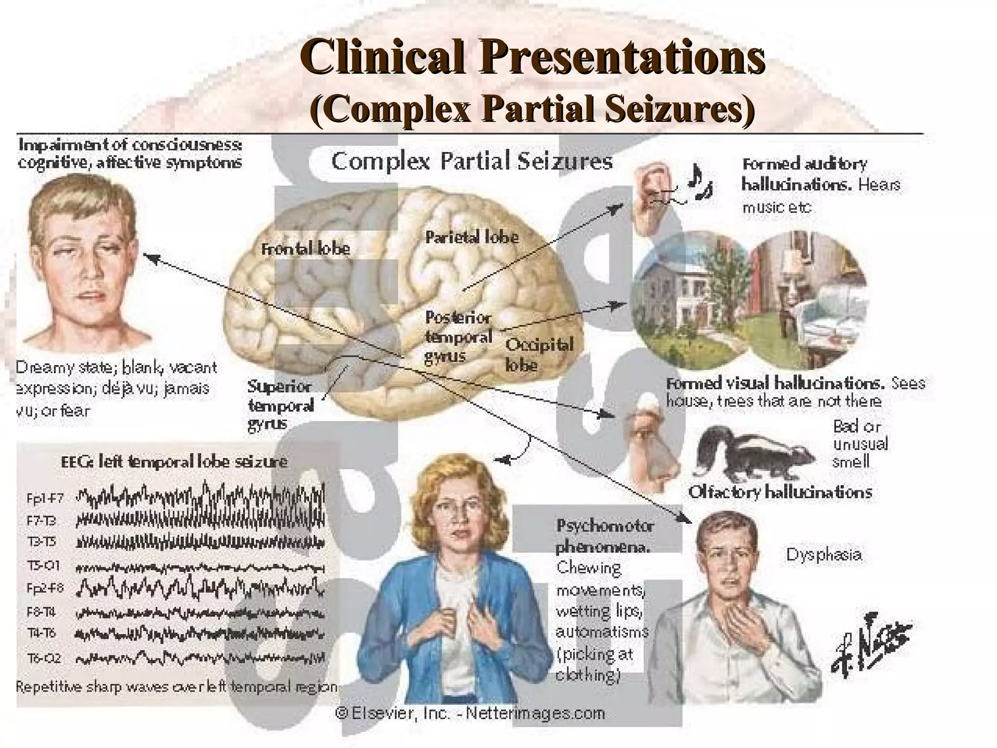 Clinical Presentations (Complex Partial Seizures) Definition: 