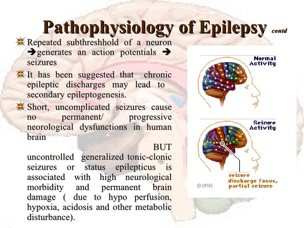 Epilepsy An Overview