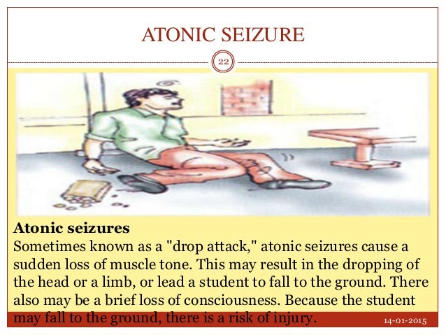 Atonic Seizures In Adults 83