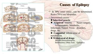 Causes of EpilepsyCauses of Epilepsy
In 30%In 30% cases cause can be determined.
Rests (70%) are Idiopathic.
Determined causes:
Inherited genetic
 Acquired : trauma, Neuro surgery,
Inflammatory, Metabolic,
Infections, Tumor, Toxic disorders,
drugs, etc.
 Congenital: inborn error of
metabolism.
Withdrawal of drugsthdrawal of drugs
AAlcohol,Benzodiazepine,
Barbiturates, Other Anti- Epileptics
 