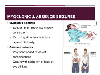 MYOCLONIC & ABSENCE SEIZURES
 Myoclonic seizures
• Sudden, brief, shock like muscle
contractions
• Occurring either in one limb or
spread bilaterally
 Absence seizures
• Very short period of loss of
consciousness
• Occurs with slight turn of head or
eye blinking 13
 