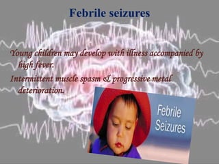 Febrile seizures
Young children may develop with illness accompanied by
high fever.
Intermittent muscle spasm & progressive metal
deterioration.
 