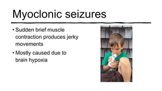 Myoclonic seizures
• Sudden brief muscle
contraction produces jerky
movements
• Mostly caused due to
brain hypoxia
 
