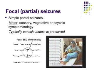 Focal (partial) seizures
 Simple partial seizures
Motor, sensory, vegetative or psychic
symptomatology
Typically consciousness is preserved
 