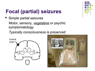 Focal (partial) seizures
 Simple partial seizures
Motor, sensory, vegetative or psychic
symptomatology
Typically consciousness is preserved
 