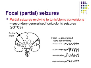 Focal (partial) seizures
 Partial seizures evolving to tonic/clonic convulsions
– secondary generalised tonic/clonic seizures
(sGTCS)
 
