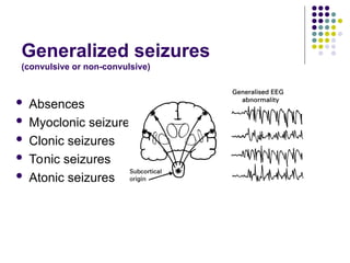Generalized seizures
(convulsive or non-convulsive)
 Absences
 Myoclonic seizures
 Clonic seizures
 Tonic seizures
 Atonic seizures
 
